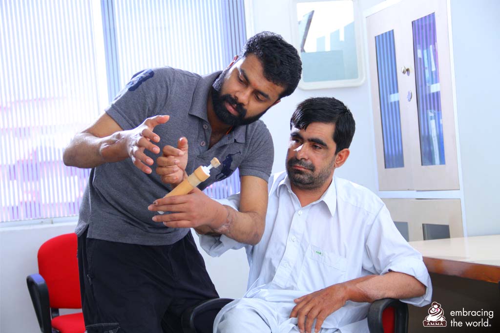 Doctor with patient of hand transplant