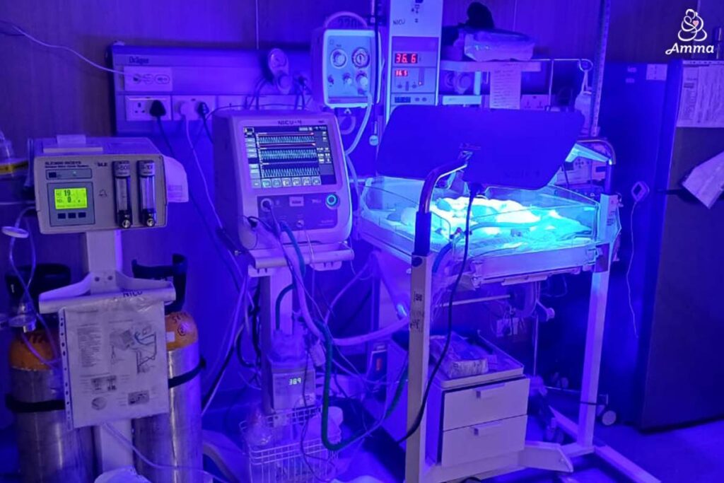 a baby in icu
