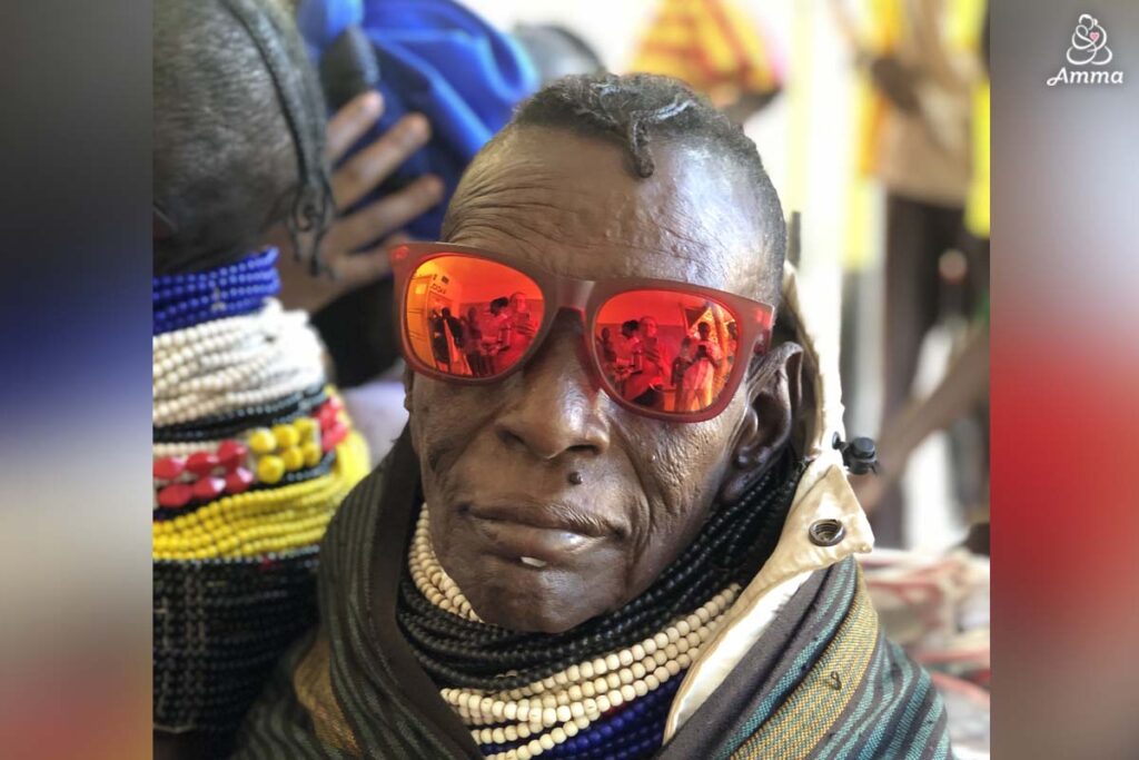 A tribal man wears sunglasses after surgery
